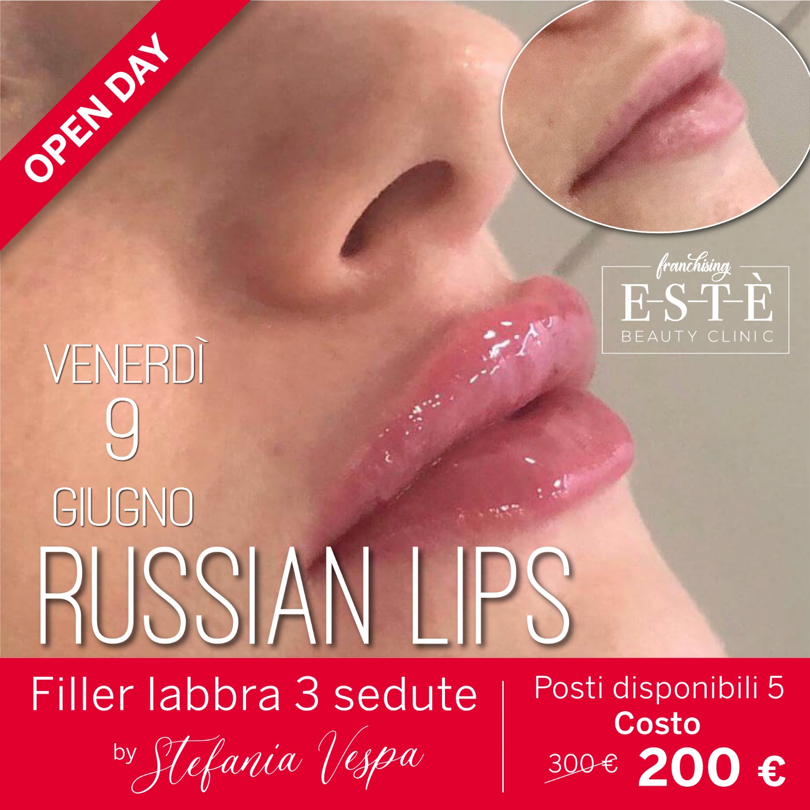 Russian Lips 9 giugno 2023 